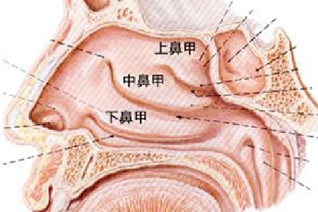 (貴陽專業(yè)治鼻炎的醫(yī)院)貴陽鼻炎的檢查方法介紹(圖2)