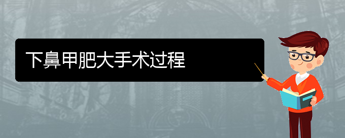 (貴陽(yáng)鼻科醫(yī)院掛號(hào))下鼻甲肥大手術(shù)過(guò)程(圖1)