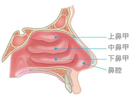 鼻甲肥大會(huì)引起面部結(jié)構(gòu)變化，還會(huì)導(dǎo)致眼袋、黑眼圈？(圖1)