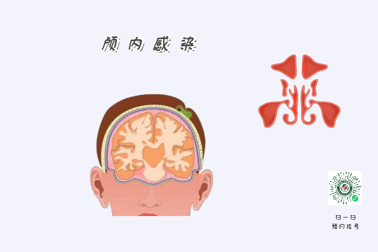 小兒鼻竇炎治療別拖延，越拖延越影響孩子的學(xué)習(xí)？(圖2)