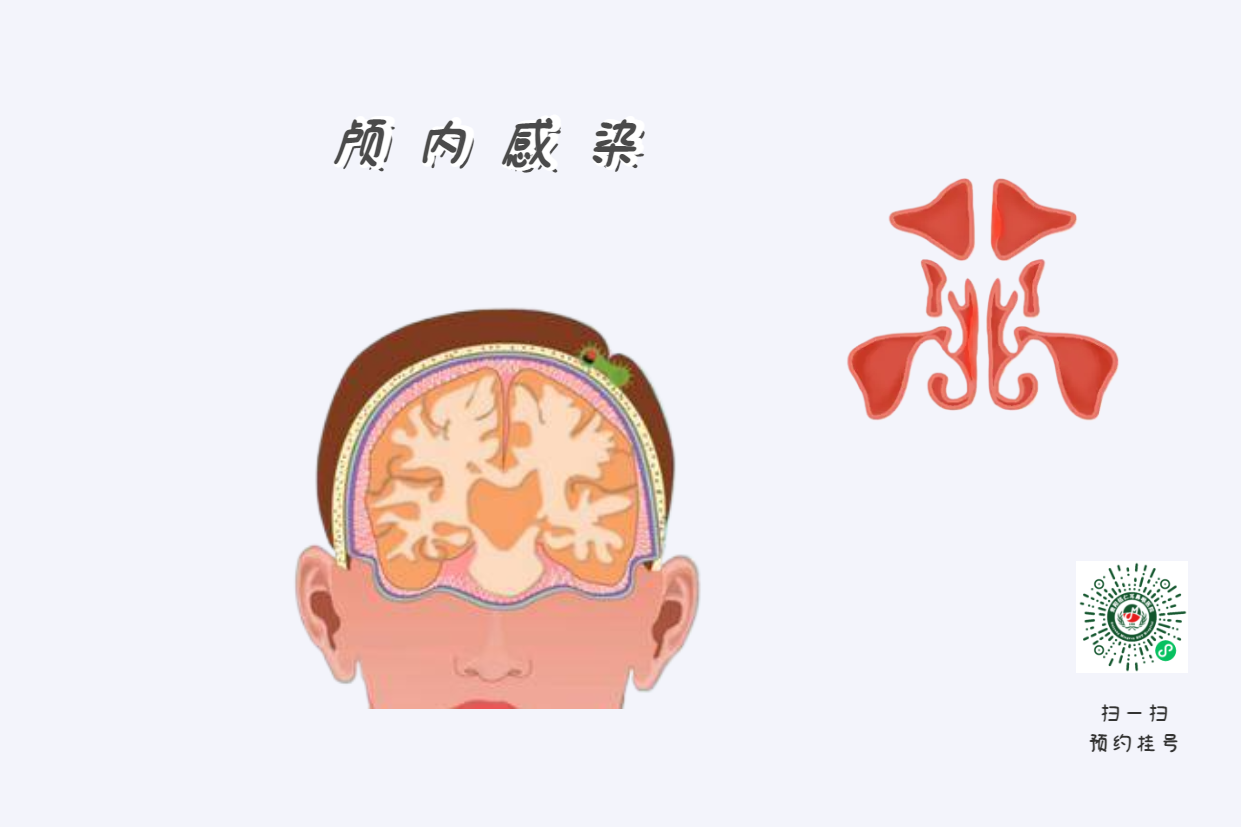 為什么患上鼻竇炎，會(huì)使孩子學(xué)習(xí)成績(jī)下降？(圖3)